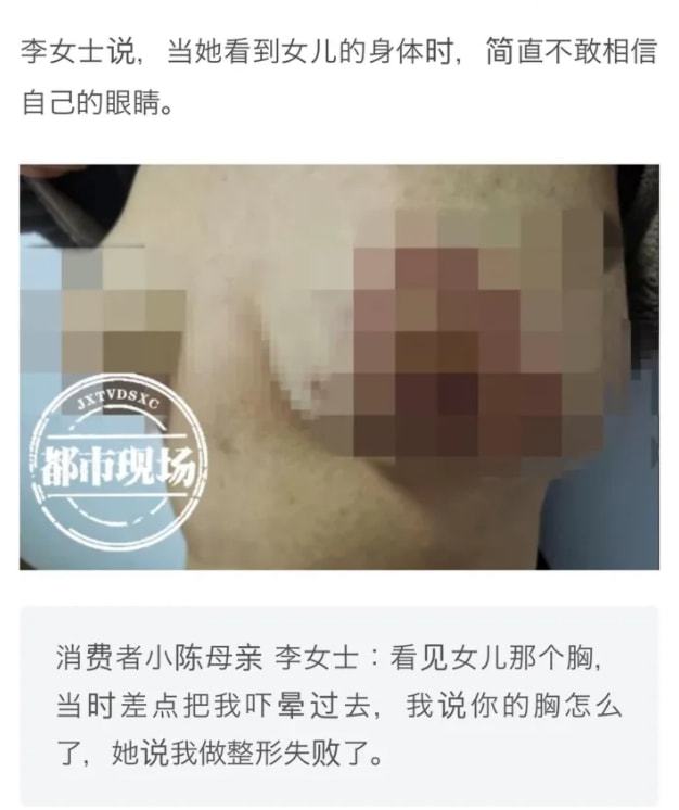 整形 女子生子后胸部下垂，花10万到医院整形，哭诉：整毁了都不敢看！