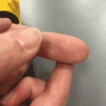 医生|肺不好，少做三事，多吃三白，勤动三处，肺部慢慢变健康！