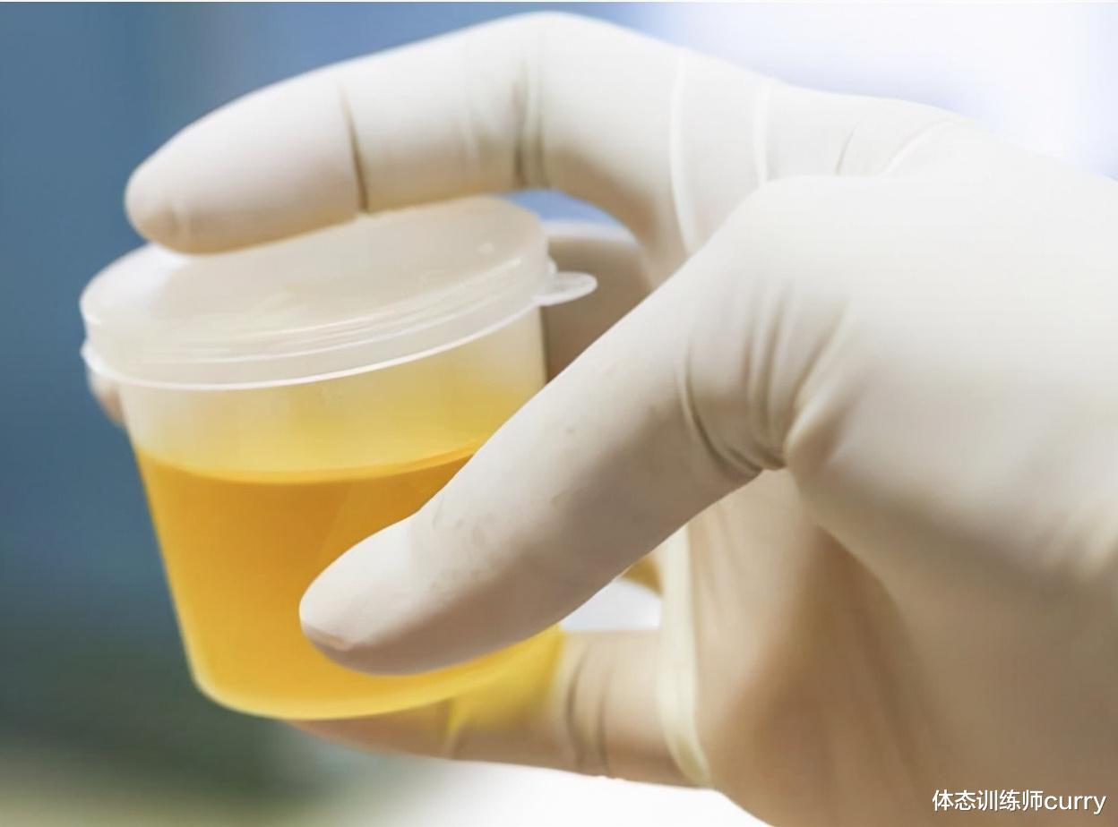 疾病|一喝水就尿多，是哪里的原因？看完这4点，或许就会明白了