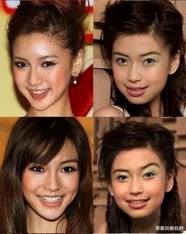 整容|有种倔强叫“我没整容”！明明从大饼脸变成了V脸，当观众瞎吗？