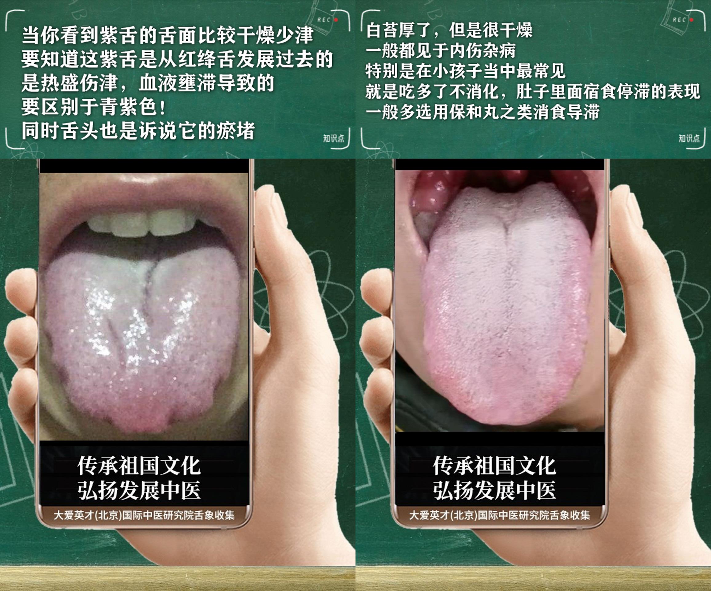 失眠|中医医案：反复胃痛，胸闷，心烦失眠，排便无力，记忆力下降