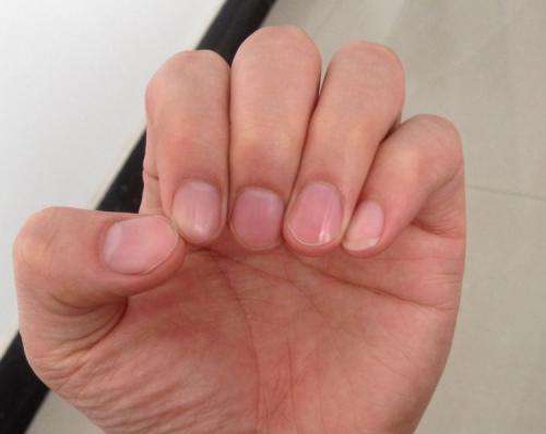 蛋白质|中医：自查“肝”好不好，这5点为主要