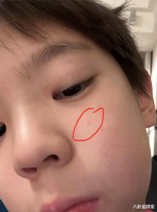 杜江|9岁嗯哼发自拍，咨询杜江长痘相关，陷入自我怀疑，却被夸太可爱