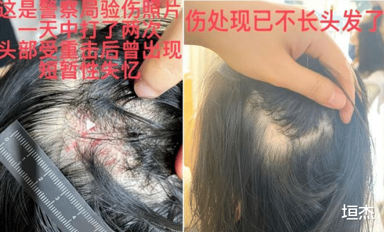 王东|2天7个瓜，婆婆赶出门，公公开车撞，被曝当小三多年，个个不简单