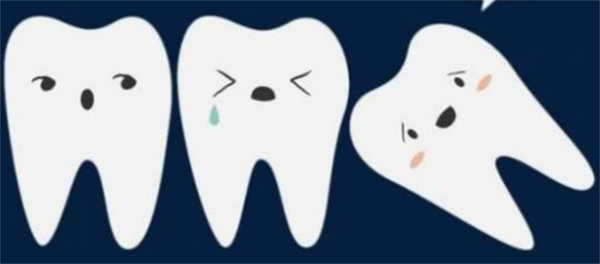 |智齿最好什么时候拔?