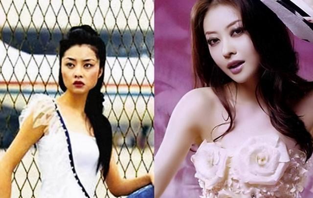 整容|长得“歪瓜裂枣”,整得“如花似玉”,这些女星都靠脸逆天改命