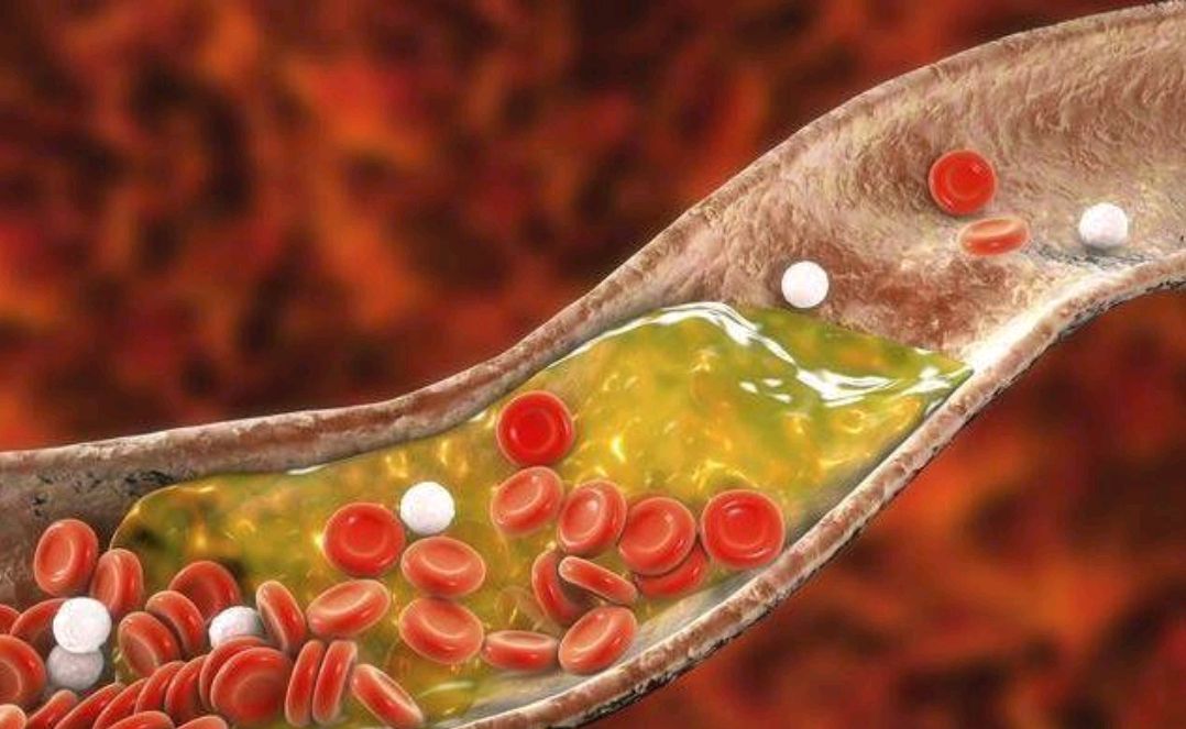 降血脂|晚餐或许是降血脂的好时机,多吃5种食物,有利于血脂稳定不超标