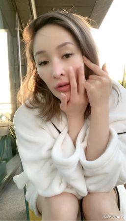 萧亚轩|萧亚轩曝右脸伤疤“像少一块肉”:我爱我自己!遭疑要当张惠妹嘉宾