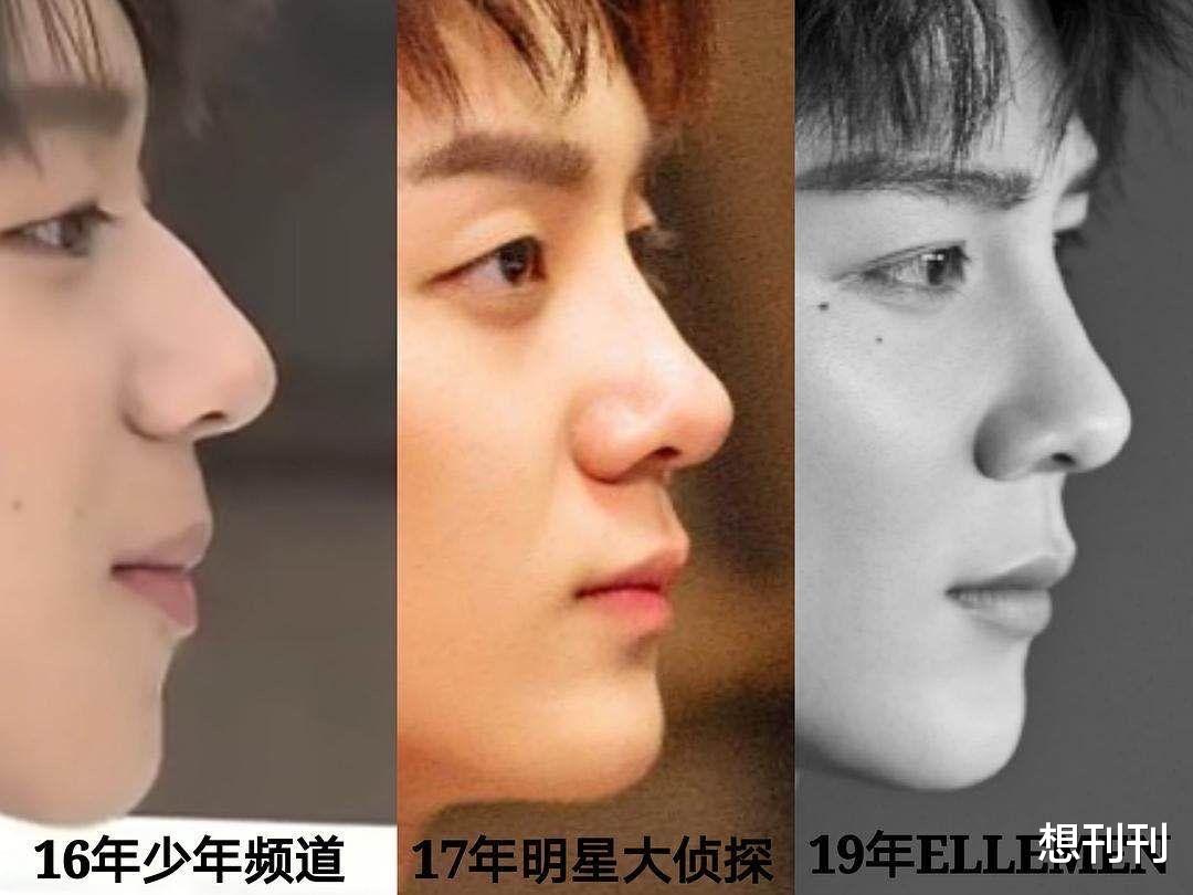 整容|出道了还去整容？换了张脸再出来，自封纯天然，他们当观众傻吗？