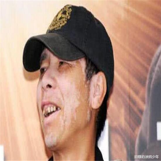 冯小刚|有钱也治不好病的明星，张嘉译患上不死癌症，冯小刚让人觉得心疼