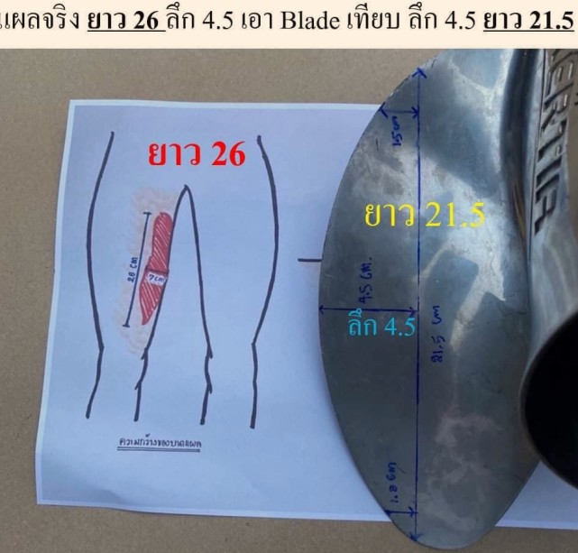 |女星西瓜遗体照遭泄露：状况极为惨烈，脖子明显勒痕