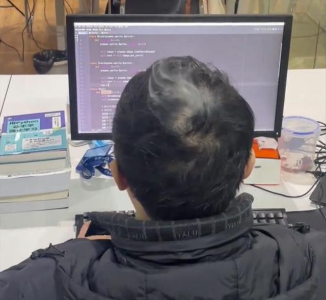 机器|写代码写着写着头发着火了，官方解释来了，网友回答：扎心了众人