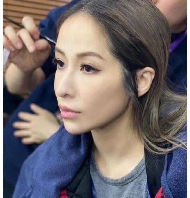 张柏芝|张柏芝被爱宠狗咬伤，露出痛苦的表情，网友表示不要走萧亚轩老路