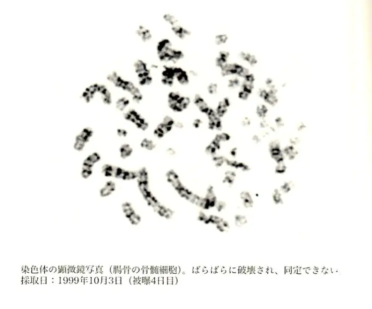 假如你身体里的DNA全部消失了,会发生什么?