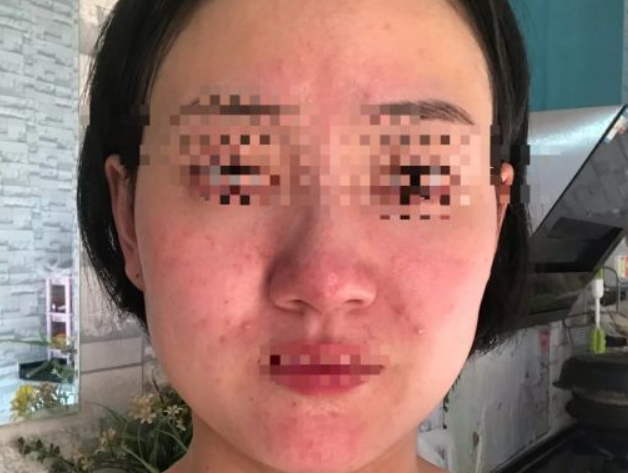 化妆品 避雷国家级警告！这些名不符实孕妇化妆品赶快扔掉，鸡肋甚至有害