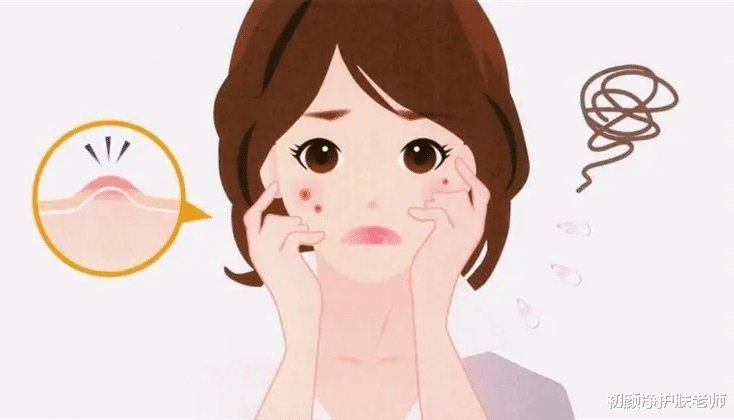 护理 敏感肌分4种,原因、特点、护理方法各不同!怎么办?看这篇!