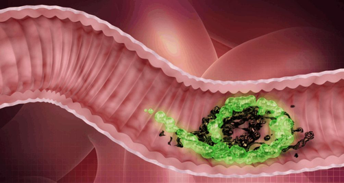 土豆|土豆号称“天然泻药”配它一起吃,排出臭宿便,体重悄悄降下去