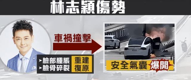 林志颖|这就是脸部3D重建?网友:看着都肉疼,林志颖得遭受多大的苦啊!