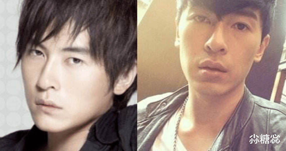 整容|中老年男星整容后遗症显现，表情都做不出来，演技也略显尴尬