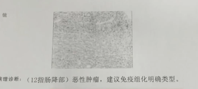 母女争夺百万遗产,法庭上女儿破口大骂,怒扇母亲耳光