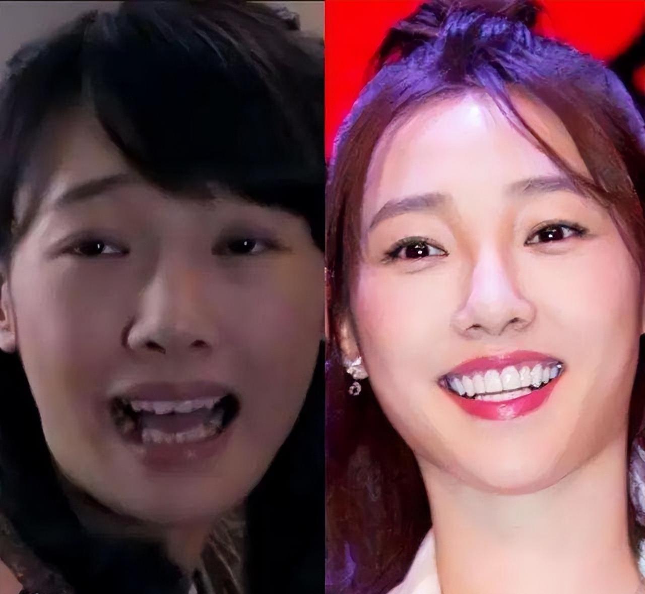 鞠婧祎|表面光鲜靓丽的“好皮囊”,它们背后都藏了哪些“假货”?