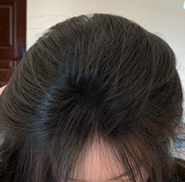 高圆圆 孕期用超市洗发水洗秃了？热门洗发水红黑榜，再不怕阿姨乱推销