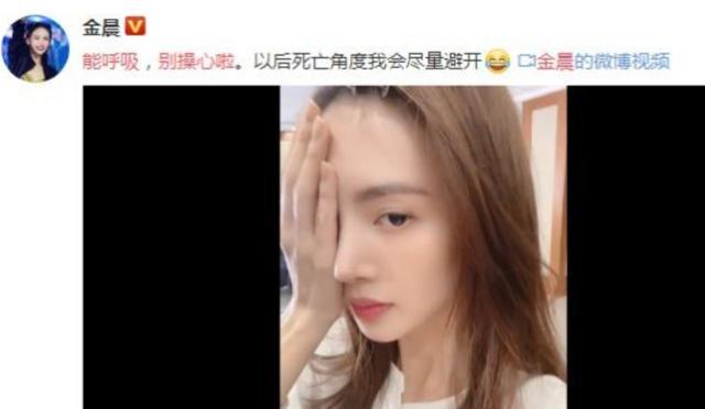 张雨绮|隆过鼻子的十位明星,张雨绮鼻梁变宽,毛晓彤很自然