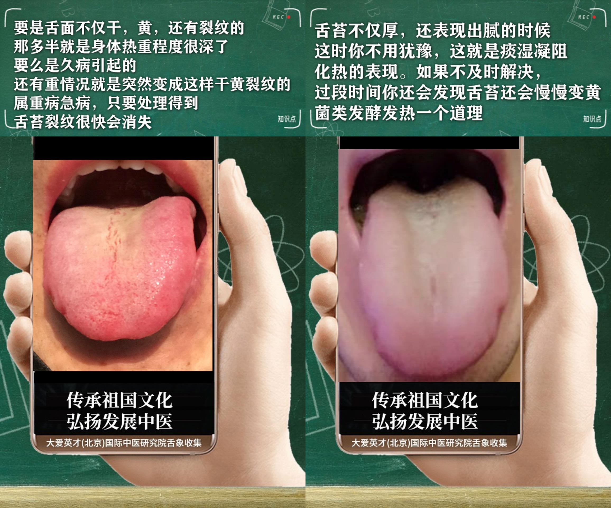 |中医解剖：常内心不安，容易出汗，鼻涕胶黏，时好时坏很难过