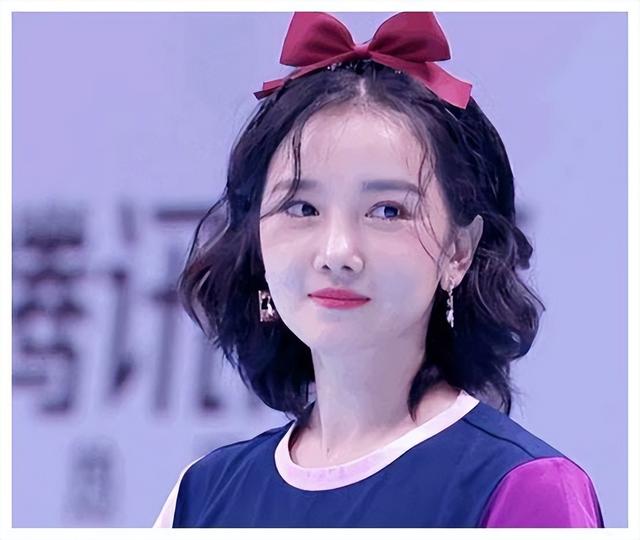 整容 明星整容后遗症:“一刀削”脸僵挂不住肉,演戏五官乱飞,没眼看