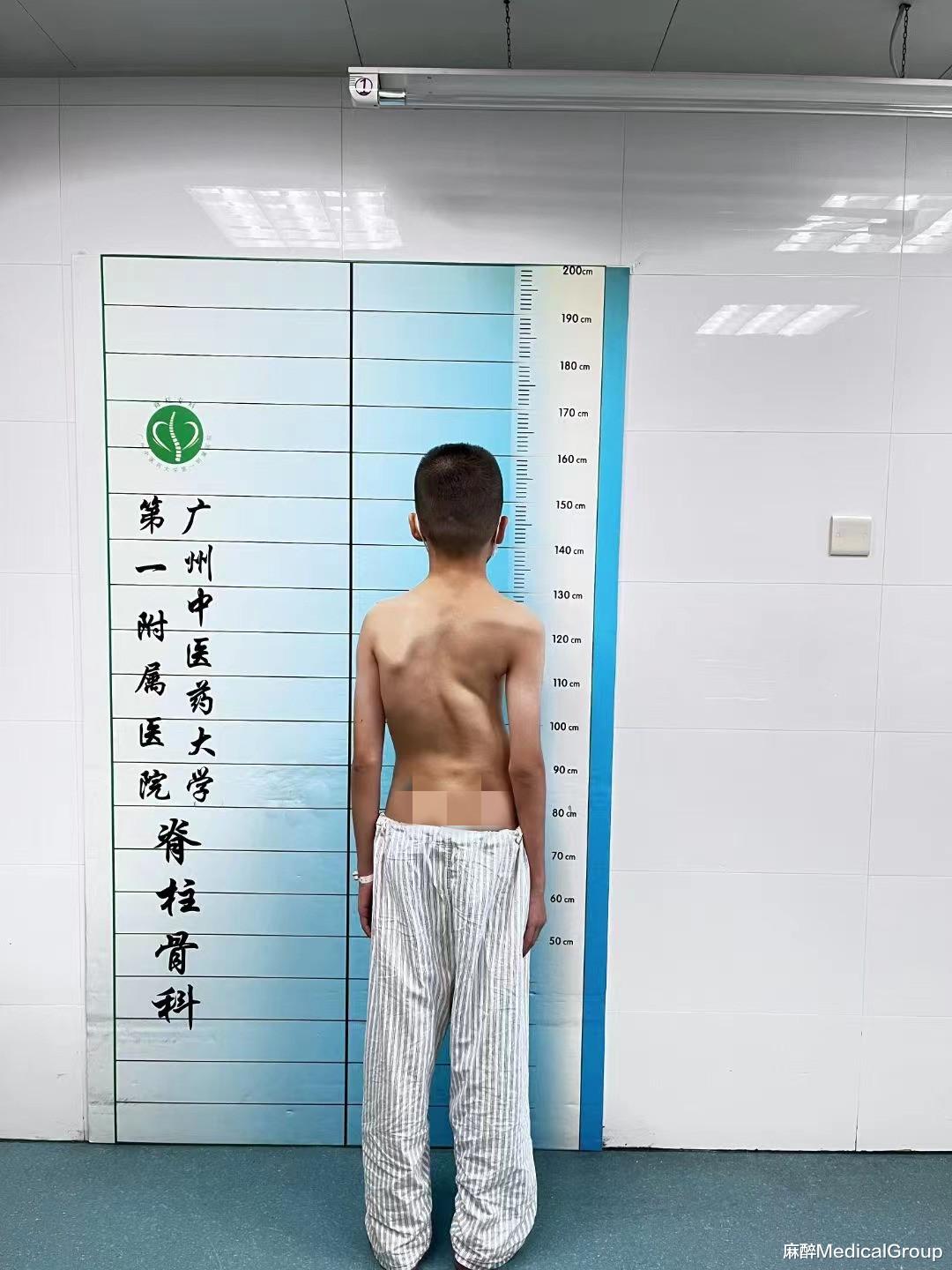 hiv|在脊柱手术围术期血液保护,我们有这些措施可做