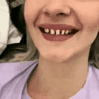 娱乐圈|骨瘦如柴、全身涂白、满嘴假牙,娱乐圈的这些“审美”真不高级