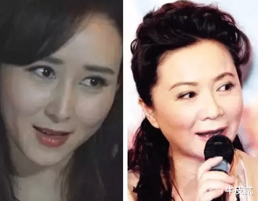 姐姐|明明“优雅自然”,却偏要“硅胶脸”的5大女星,个个苦不堪言