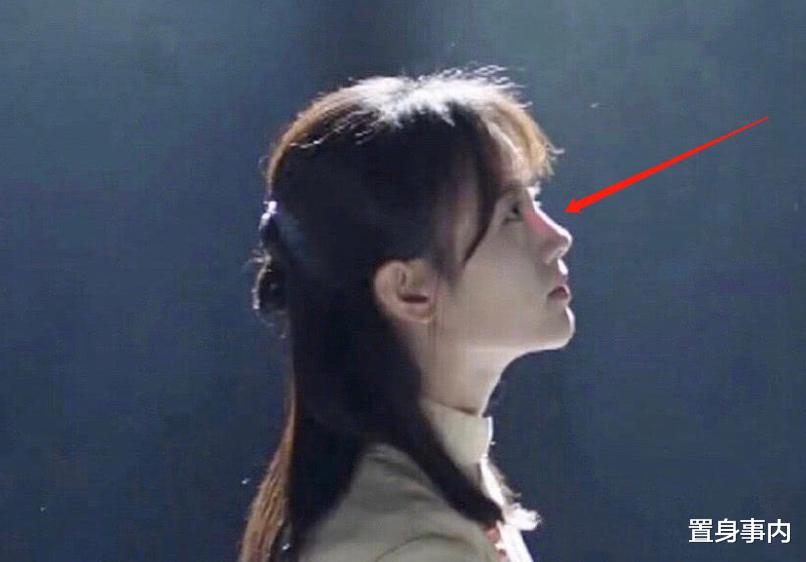 杨紫|影视圈“假鼻子”大赏:谁堪称点睛之笔,谁“越整越残”?