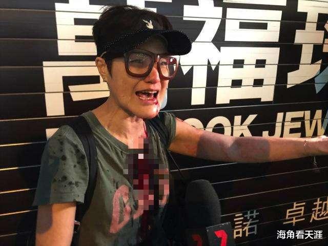 马蹄露|TVB“御用丑角”马蹄露：因爱国被打伤不后悔，坚持为大陆捐款