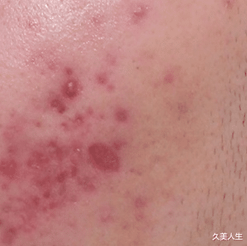 黑色素 去年美白又翻车了?点进来补课!