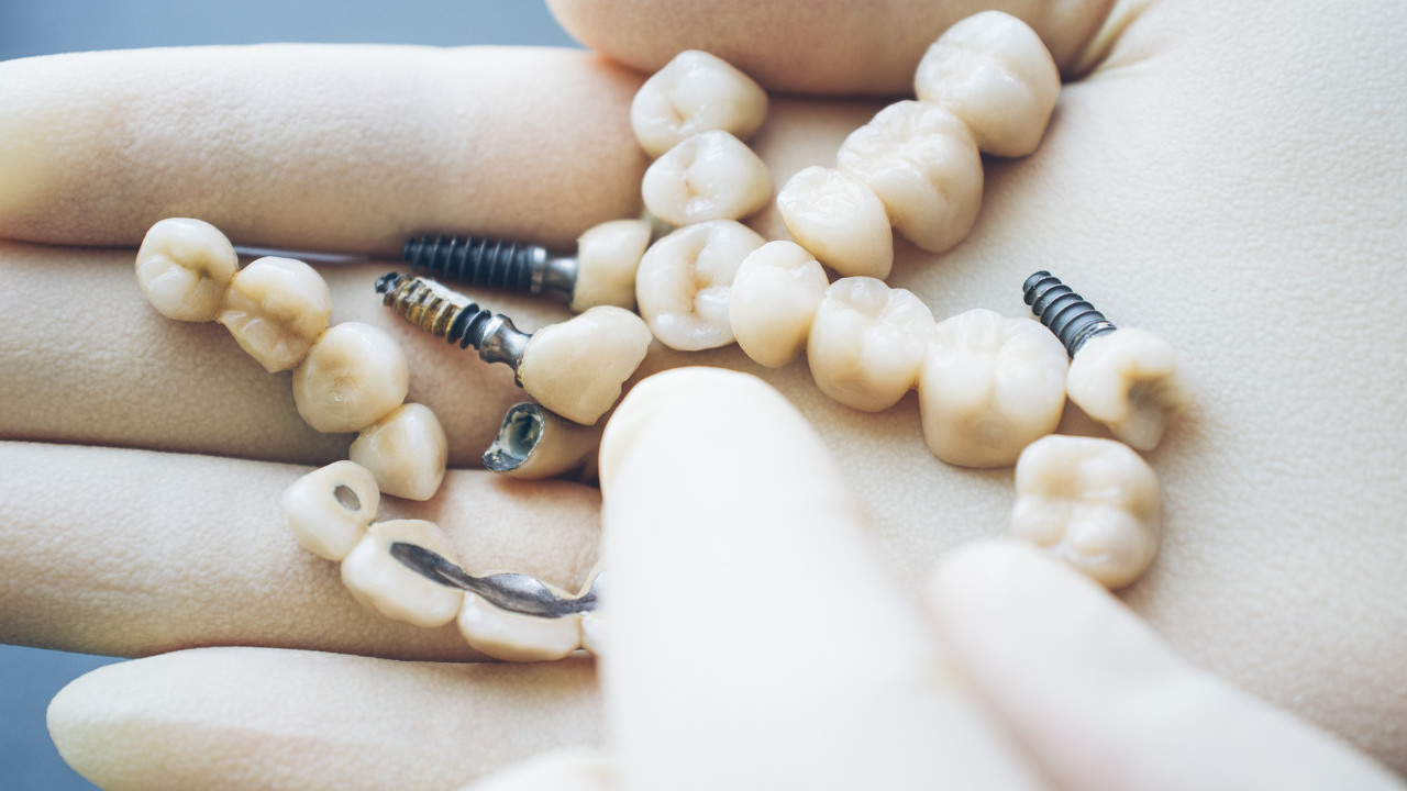 种植牙限价靴子落地，谁人高兴谁人愁？