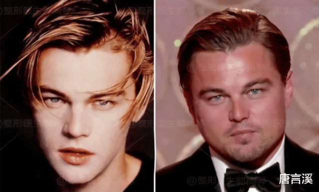 男神|男神发腮到底多可怕？看看这7位男星的“胖脸蛋”就知道了