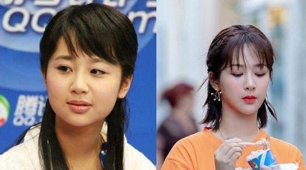 杨幂|从“大饼脸变成小V脸”的9位明星，杨幂说整了牙，金晨死鸭子嘴硬