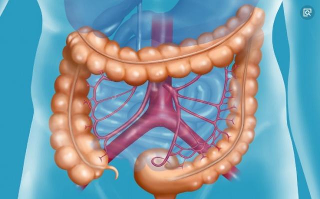 结直肠癌|“蹲厕所”时发生3个异常，可能是大肠病变的迹象，很多人没察觉