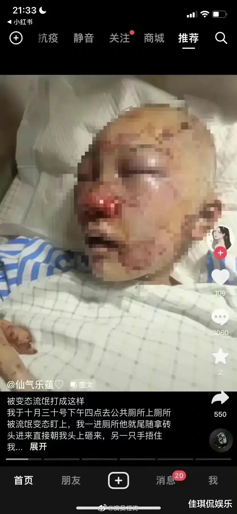 必须曝光!花季少女,被流氓殴打致面目全非!差点将女孩打死!