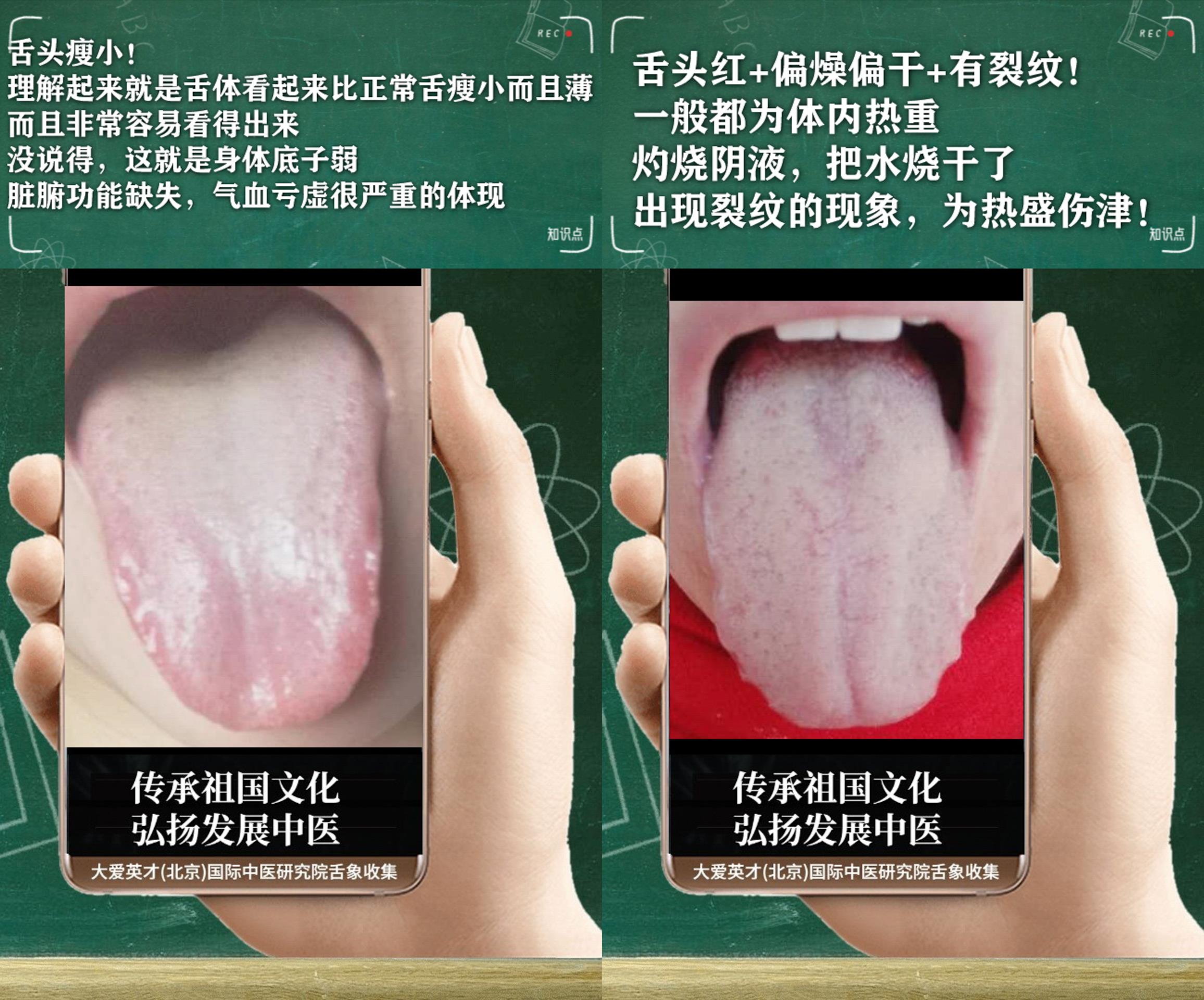 脾胃|中医实解：气短心悸，小便浑浊，大便不成形，寒湿凝滞