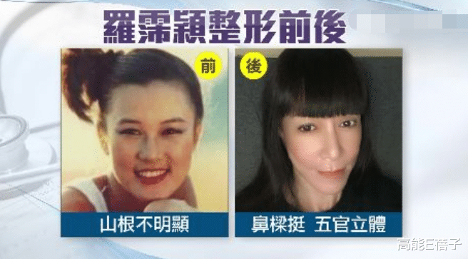 整形|台湾艺人整形记:削骨换脸小场面,嫁给医师保修终身