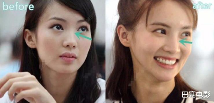 牛莉|好好的美女非去弄鼻子,林心如鼻子像被夹住,牛莉一个鼻孔两个大