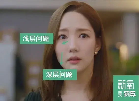 玻尿酸 她们对于“高平整度”的执念好深