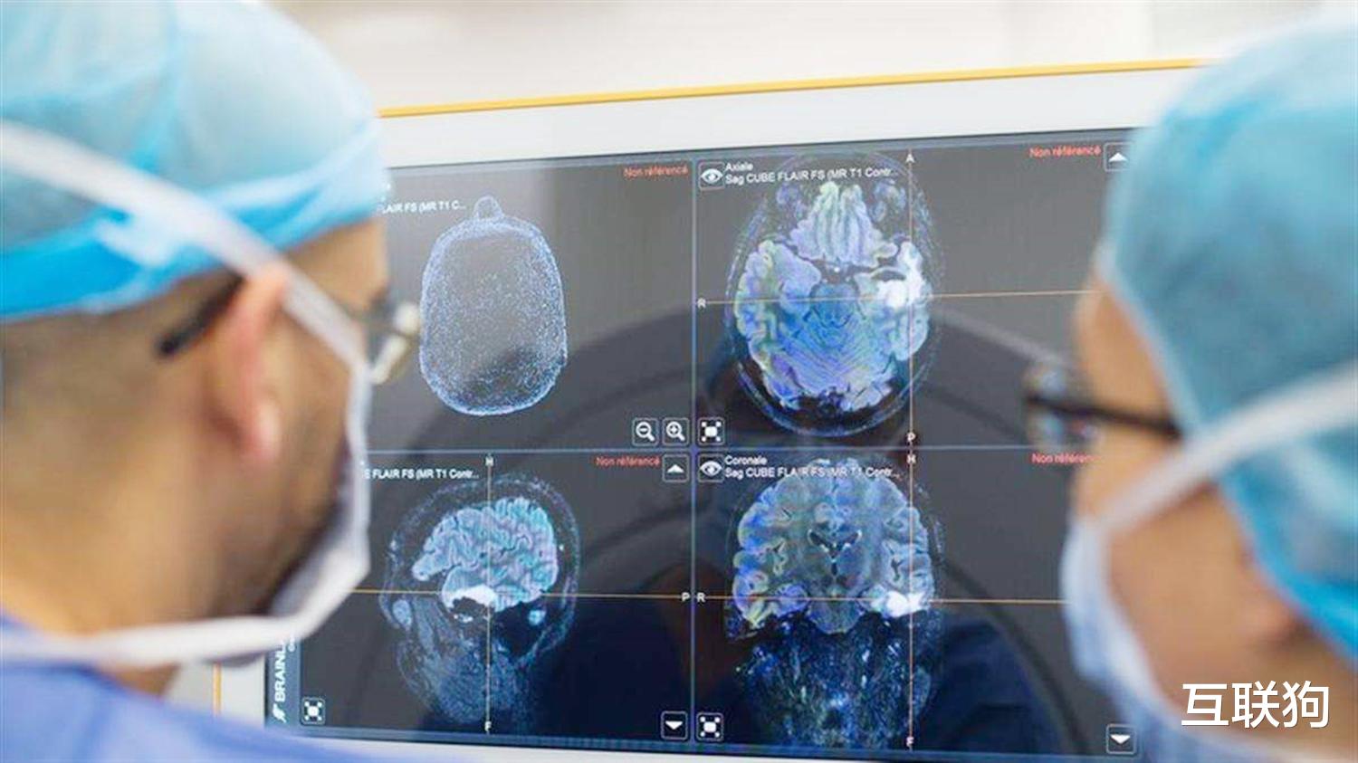 芯片|马斯克的脑机芯片将进行人体测试，“黑客帝国”或成现实？