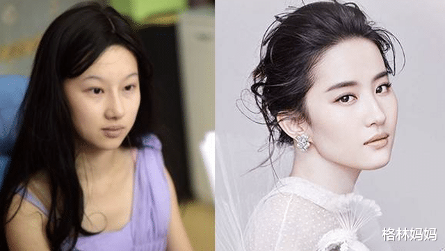 刘亦菲|19岁女孩花百万整成刘亦菲,名字也“高仿”,如今23岁判若两人