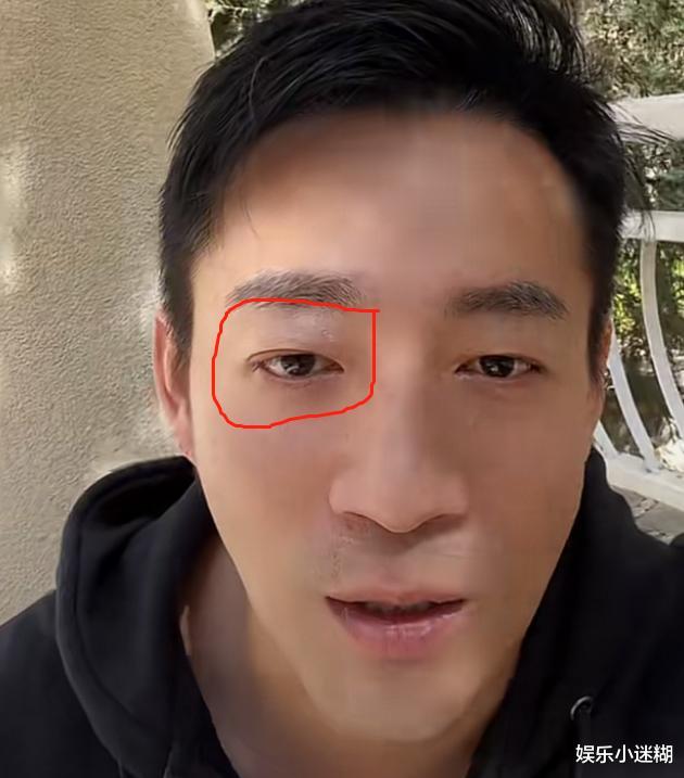 小姐姐|汪小菲疑被打后首次公开露面,眼睛肿胀未消,发声后匆匆下线