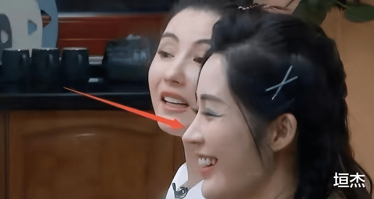 整容|脸没恢复就别演戏了，“馒头脸蛋”演啥都拉胯，这些女星羞不羞