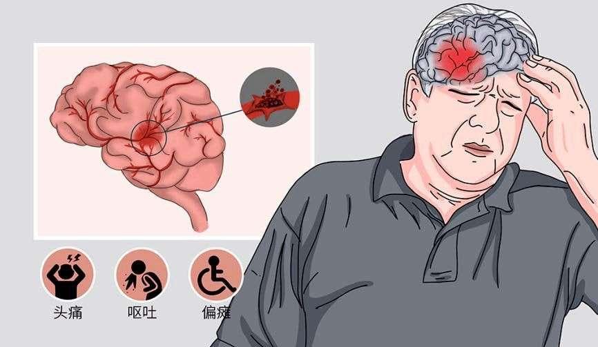 党嫂透露大娘脑出血处于半昏迷,网友希望她不能有事要坚持到最后