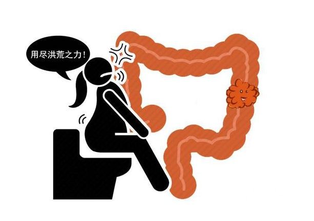 水果|长期便秘，排便不痛快，饮食注意4点，别火上浇油